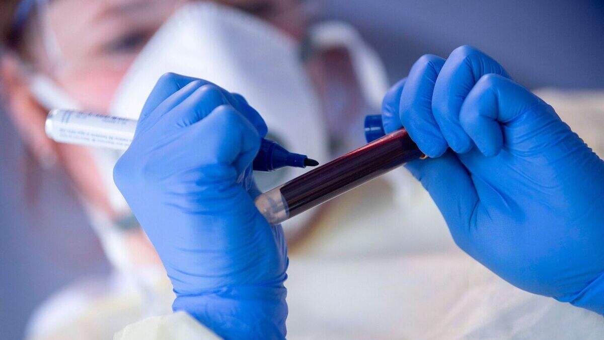 Coronavirus Ireland: Public will be asked to give blood samples for ...