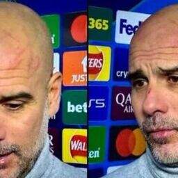 Pep Guardiola insists no intent to ‘make light’ of self harm in nose ...