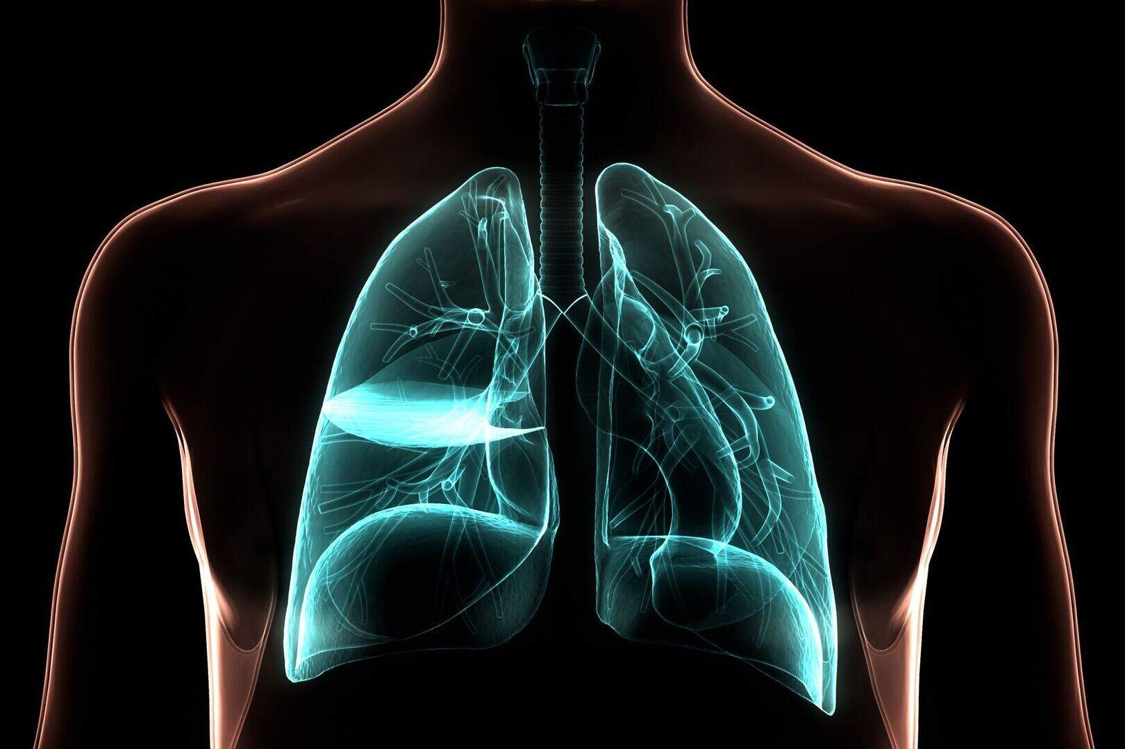 270,000 Irish people unaware they have progressive lung condition ...