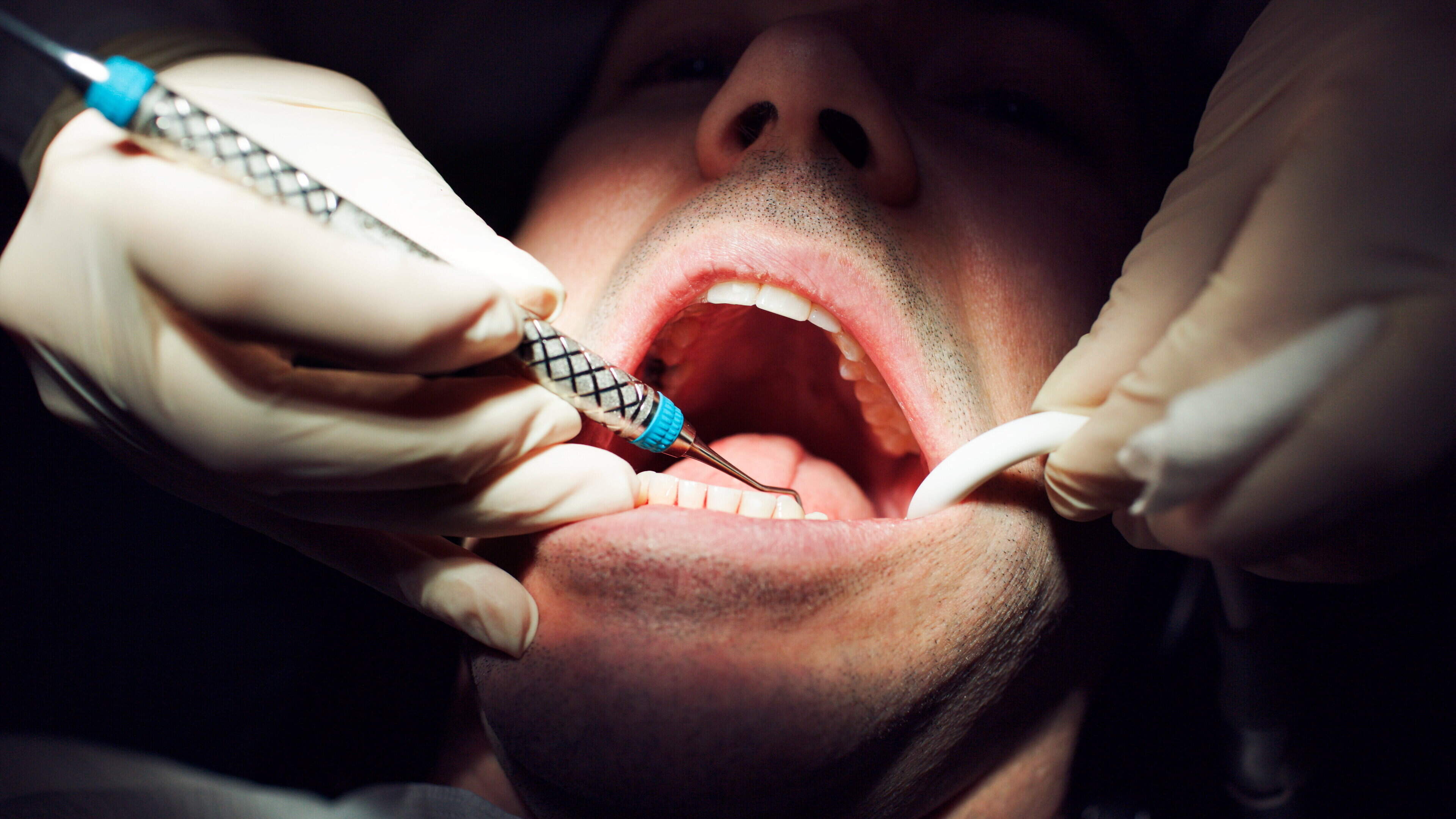Medical card dental crisis as number of participating dentists plunges to 866