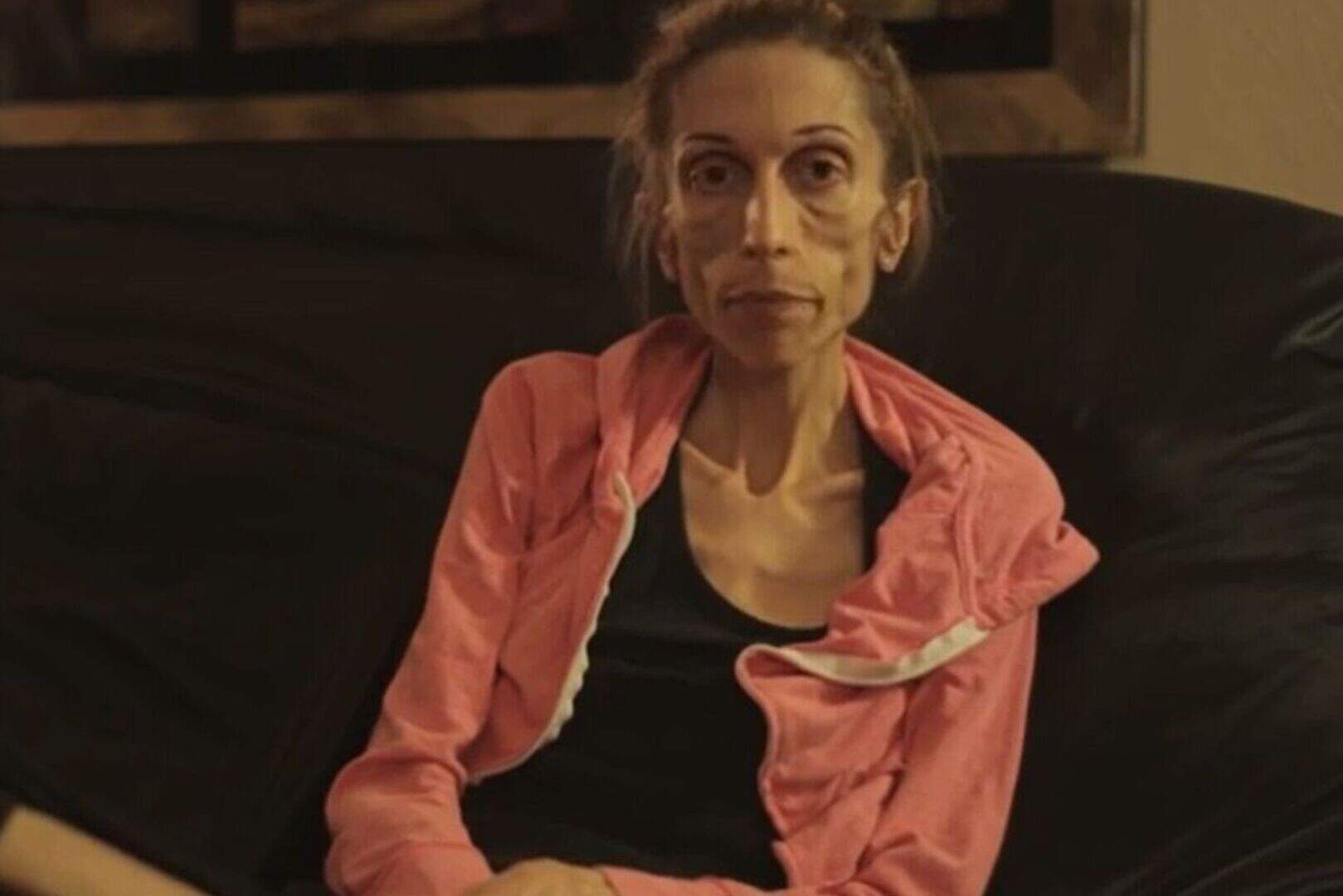 VIDEO: Anorexia sufferer Rachael (37) who weighs 40lbs pleads for life ...