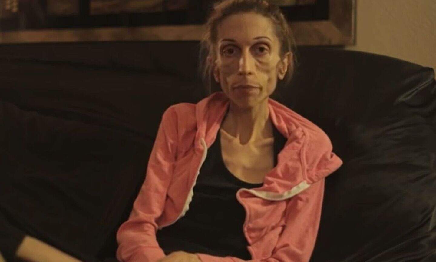 VIDEO: Anorexia sufferer Rachael (37) who weighs 40lbs pleads for life ...