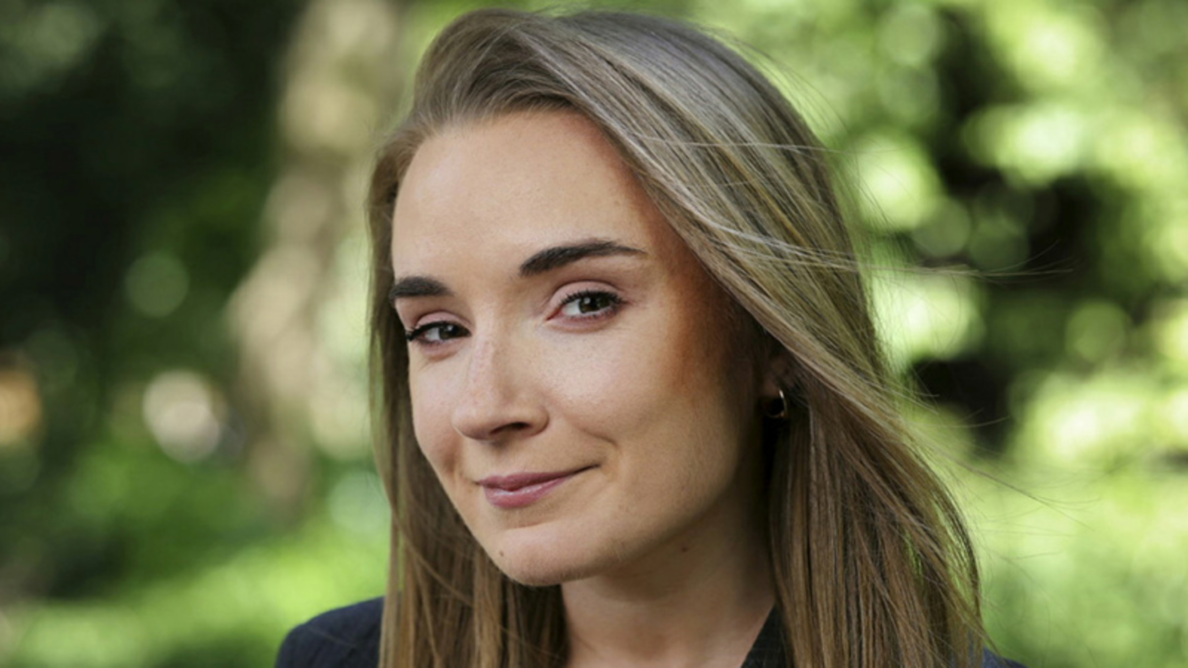 My only regret about anti-wrinkle injections at age 28? Not getting them sooner 