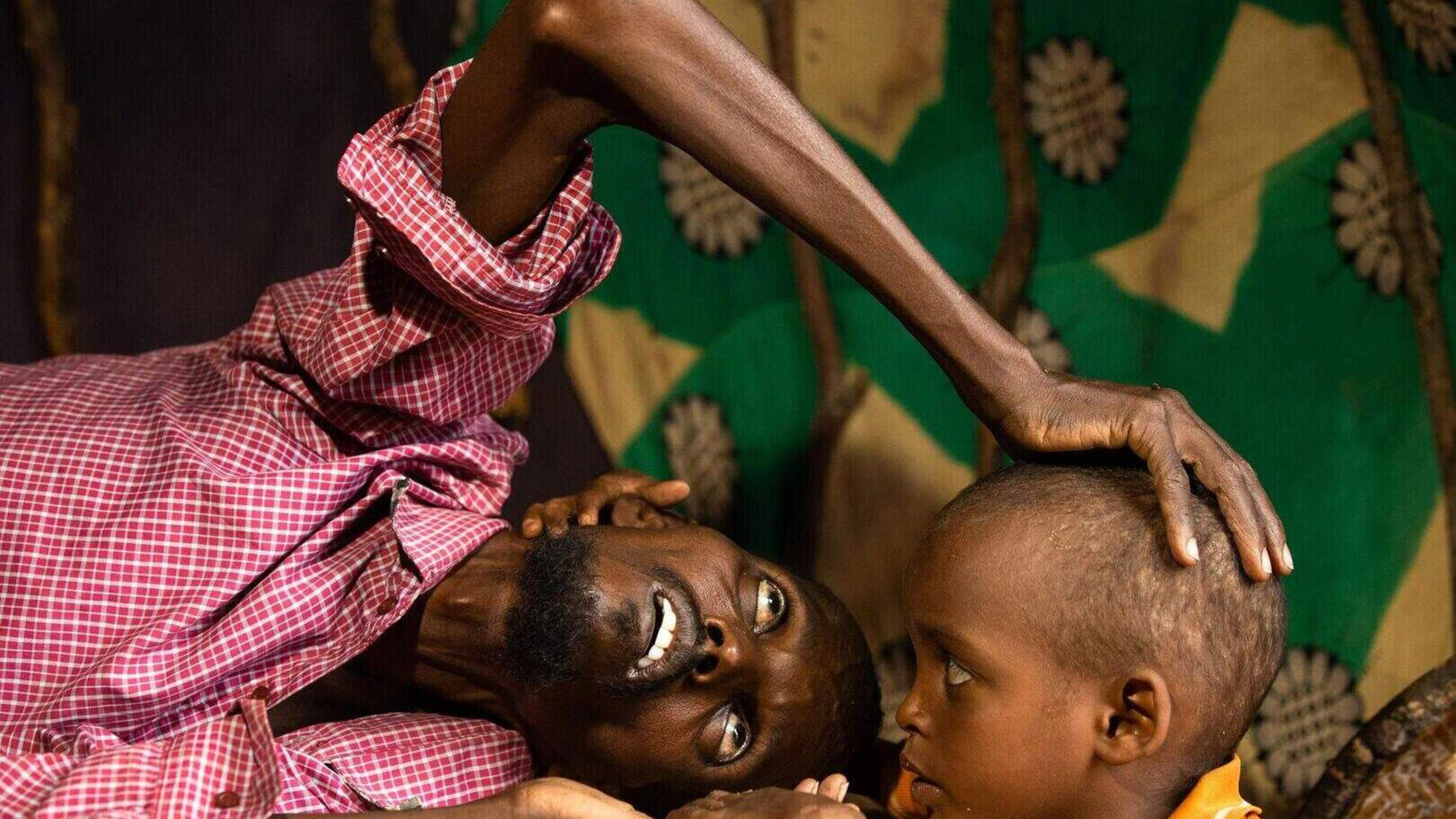 Child hunger surges in Somalia, leading charity MSF says