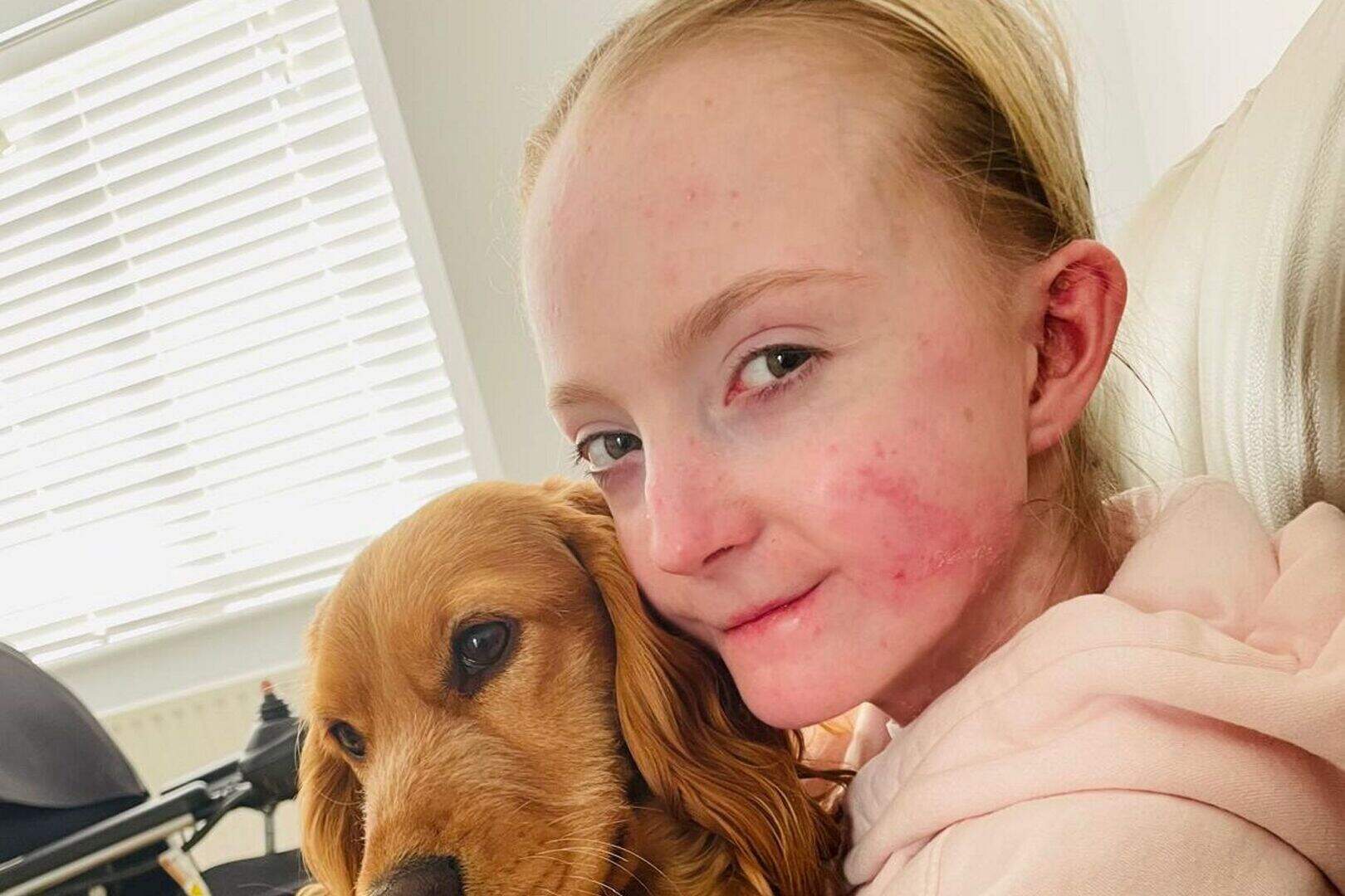 ‘EB has shaped our whole lives, it’s a monster’ – mum of Dublin woman ...