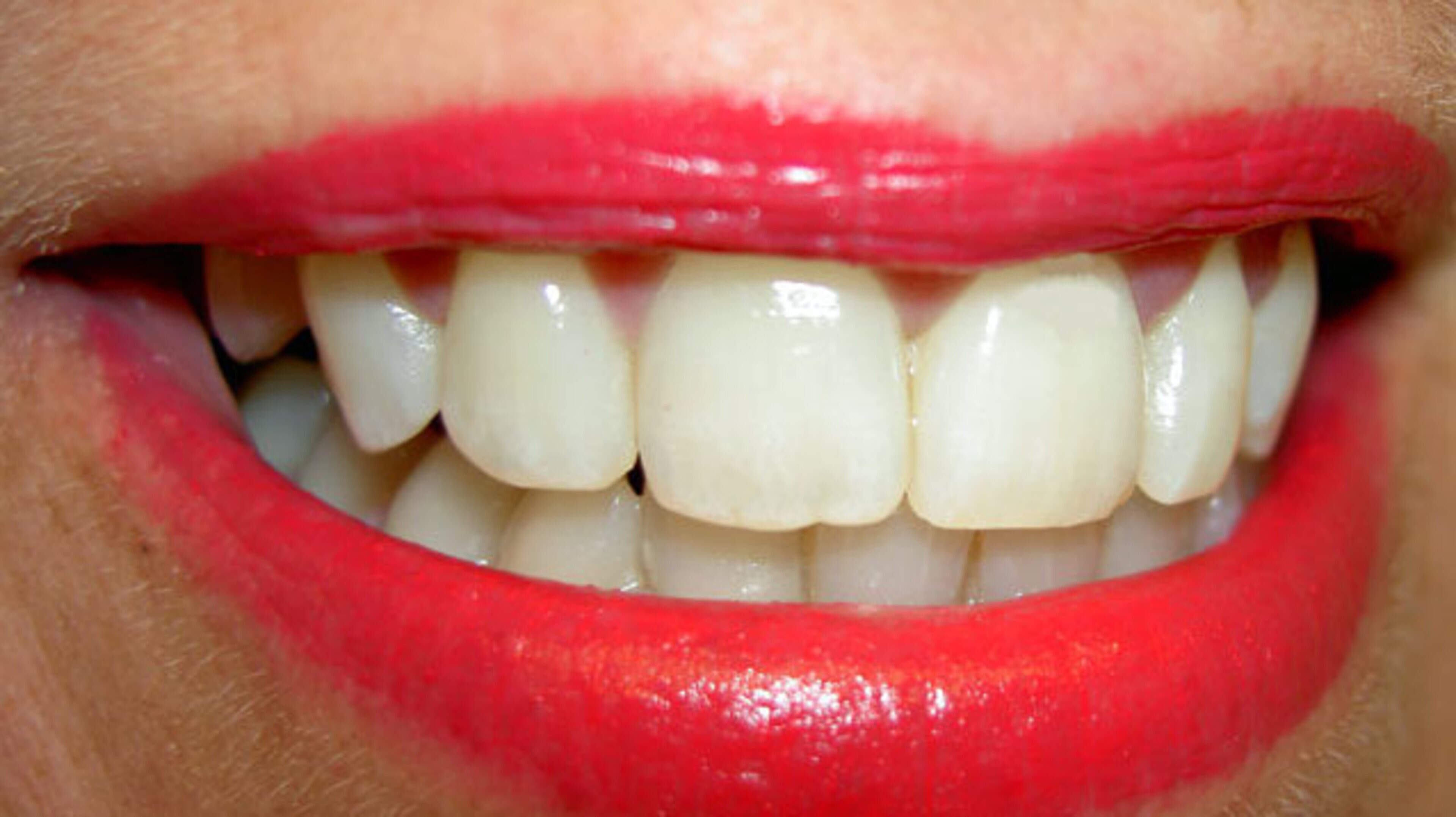 Watchdog warns consumers over illegal high-strength tooth whitening kits sold online in Irish market