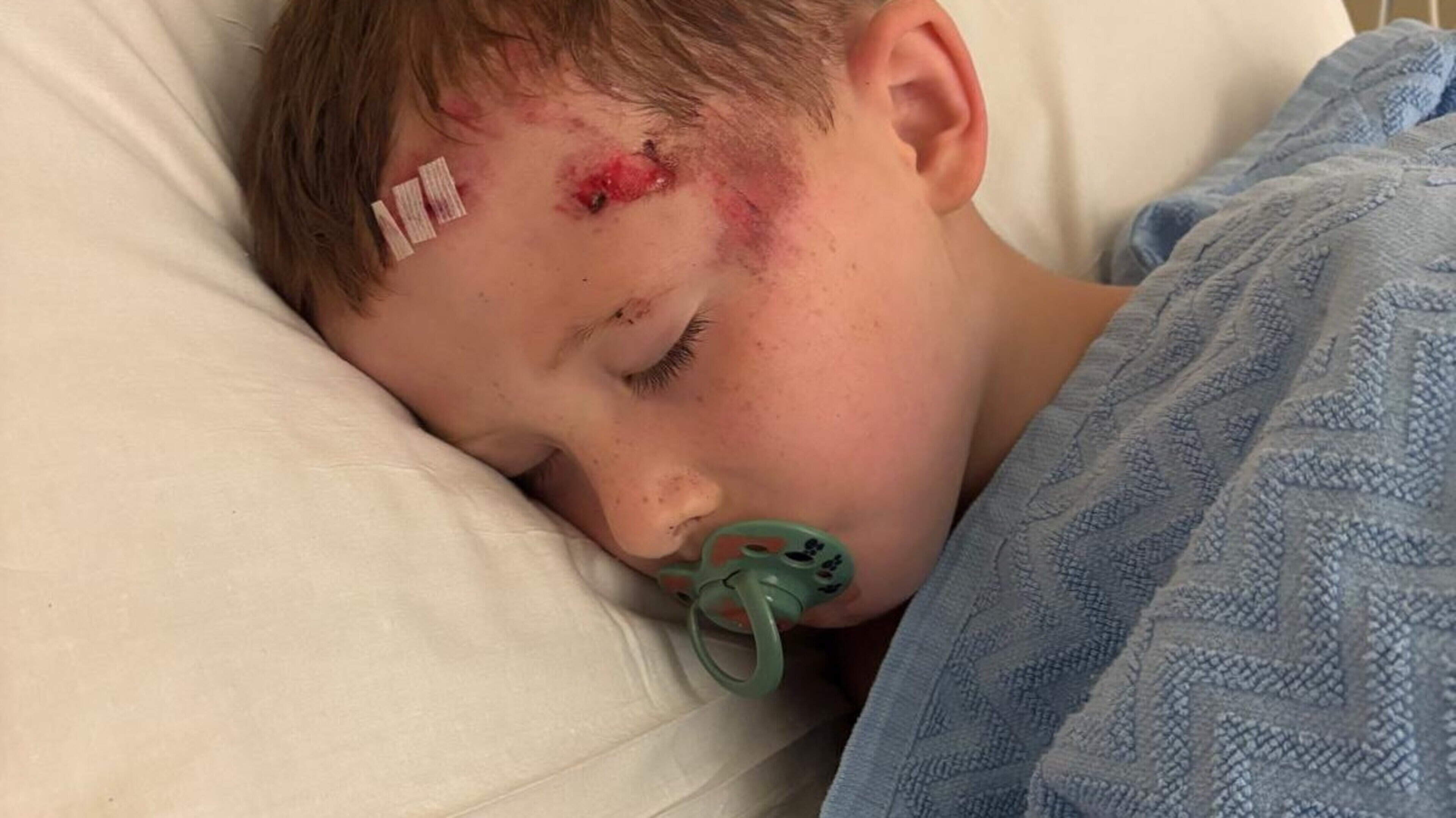 Kerry mother calls for ban on e-scooters after her son (6) suffers fractured skull in collision 