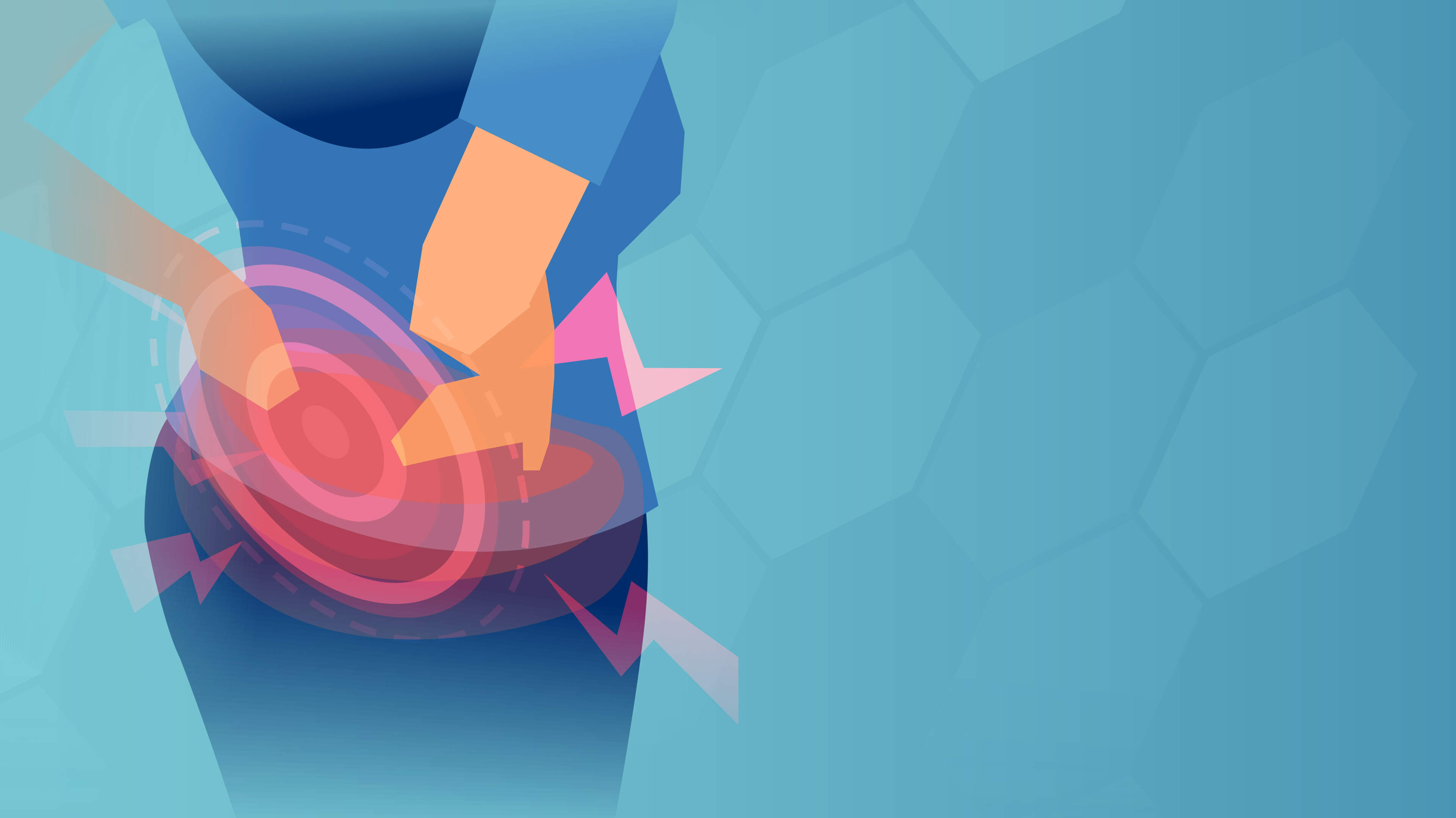 Stay Well: My GP told me I have sciatica. What is it and how do I treat it?