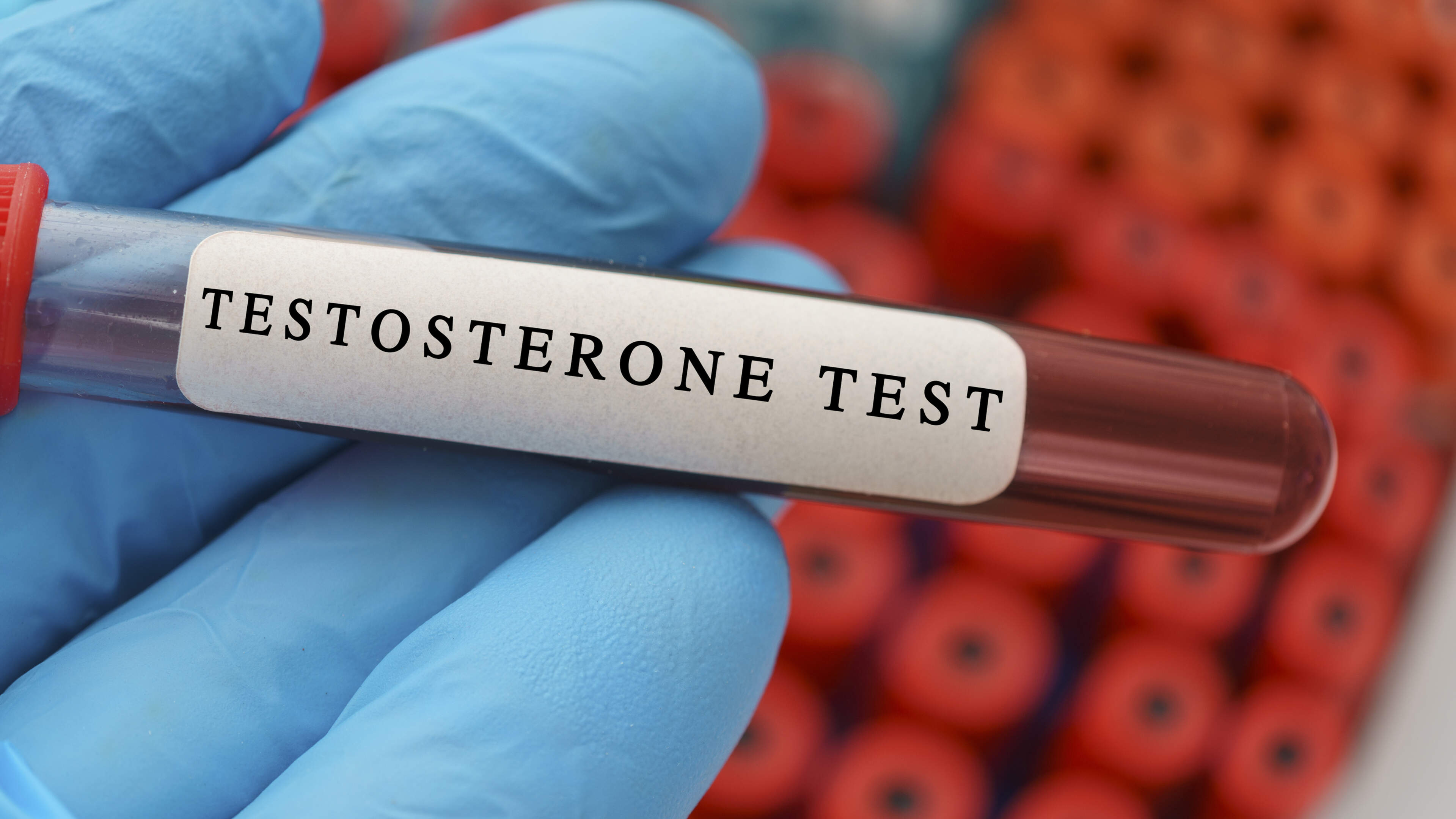 Men’s testosterone levels have fallen by half in last 50 years, scientists warn