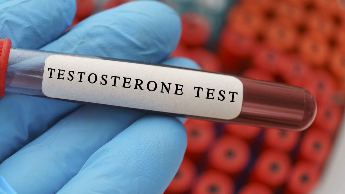 Men’s testosterone levels have fallen by half in last 50 years ...