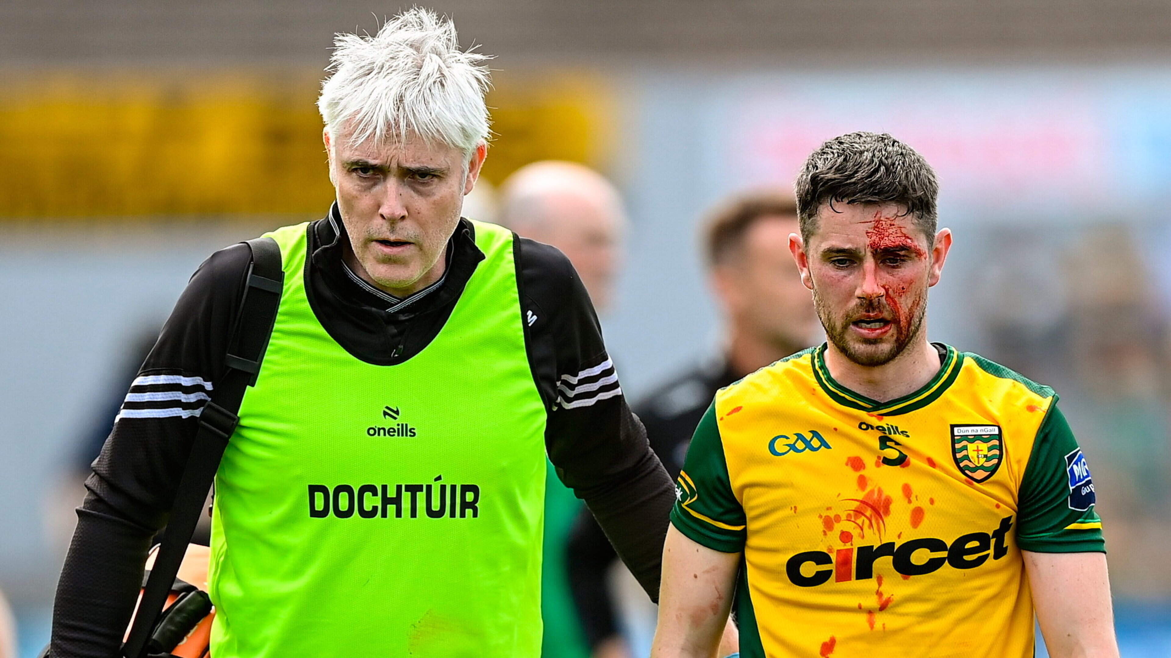 Fourteen-man Kerry left battered, bruised, down if not quite out by Donegal in spiky All-Ireland opener