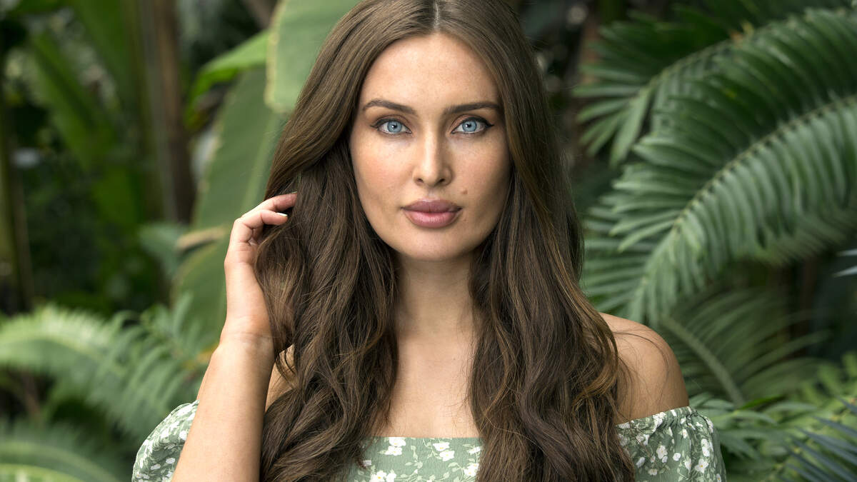 Roz Purcell: „Ich habe Alopecia areata. Es begann damit, dass mir auf ...