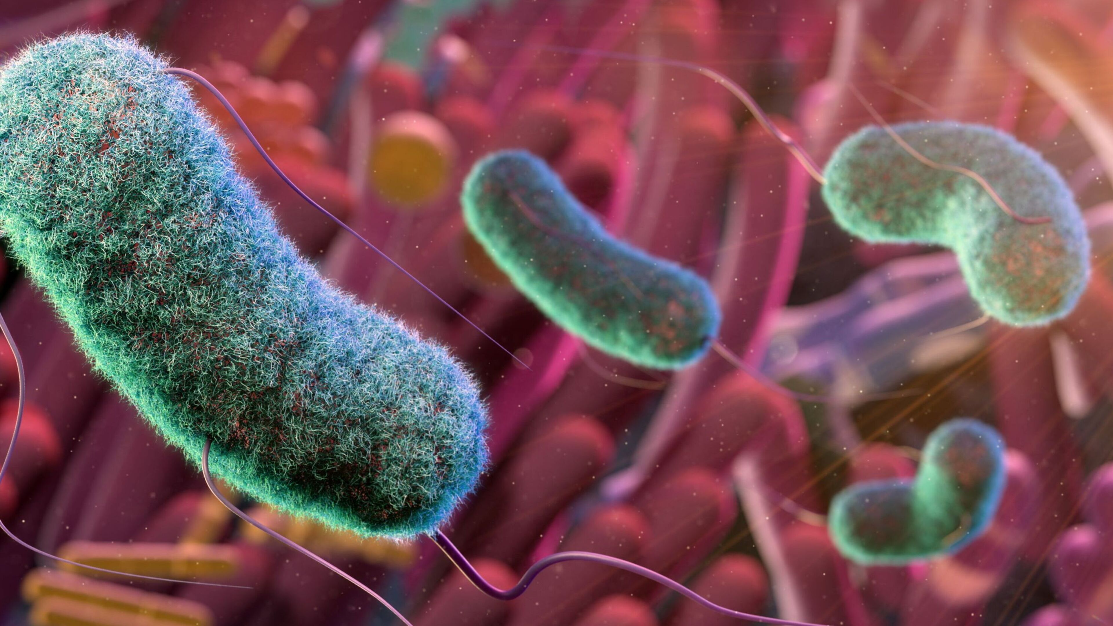 Irish doctors have uncovered the first EU case of gastro ‘superbug’ carrying an antibiotic-resistant gene