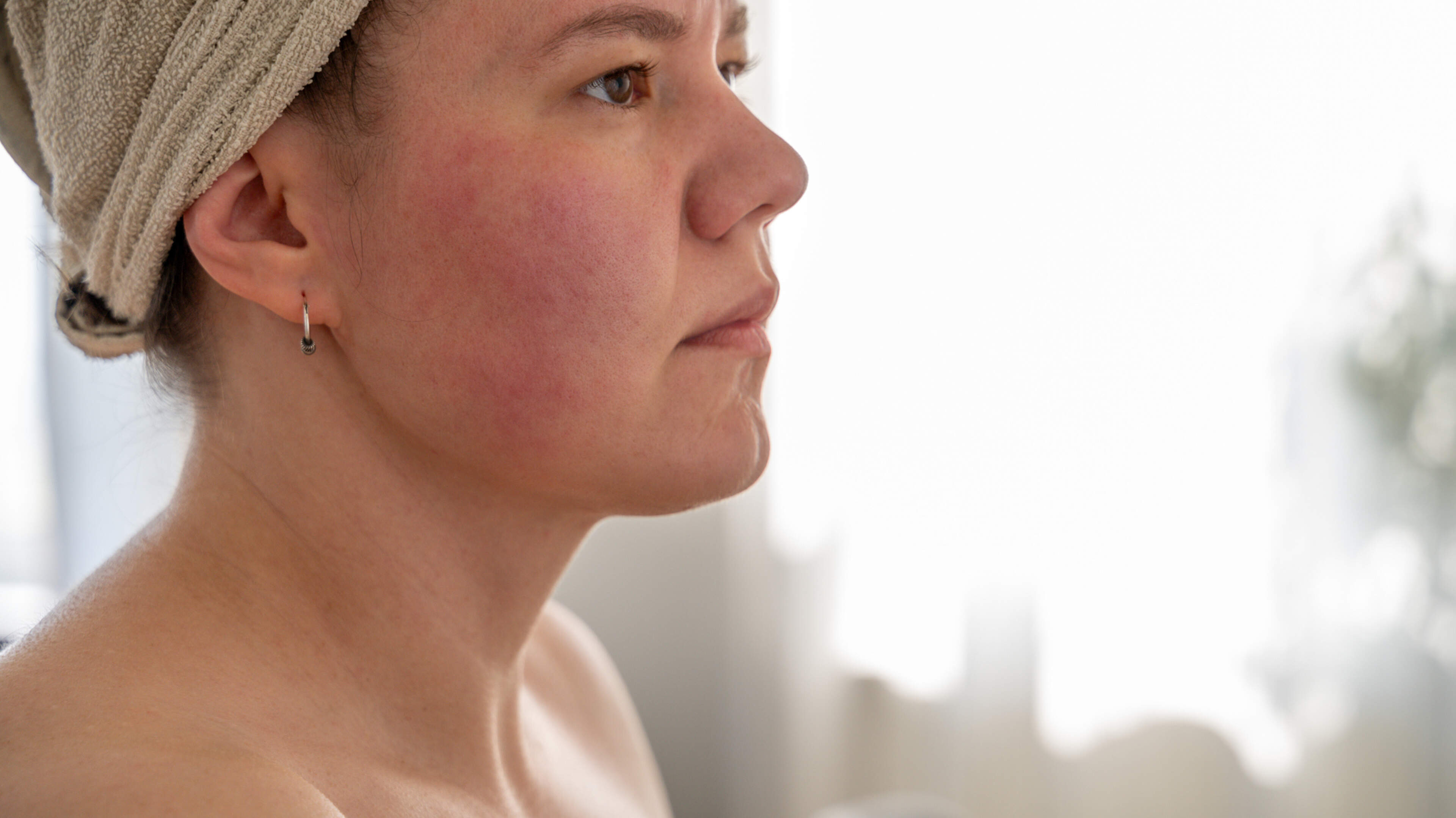 Here’s what happened when... I tried out the hypochlorous acid skincare trend