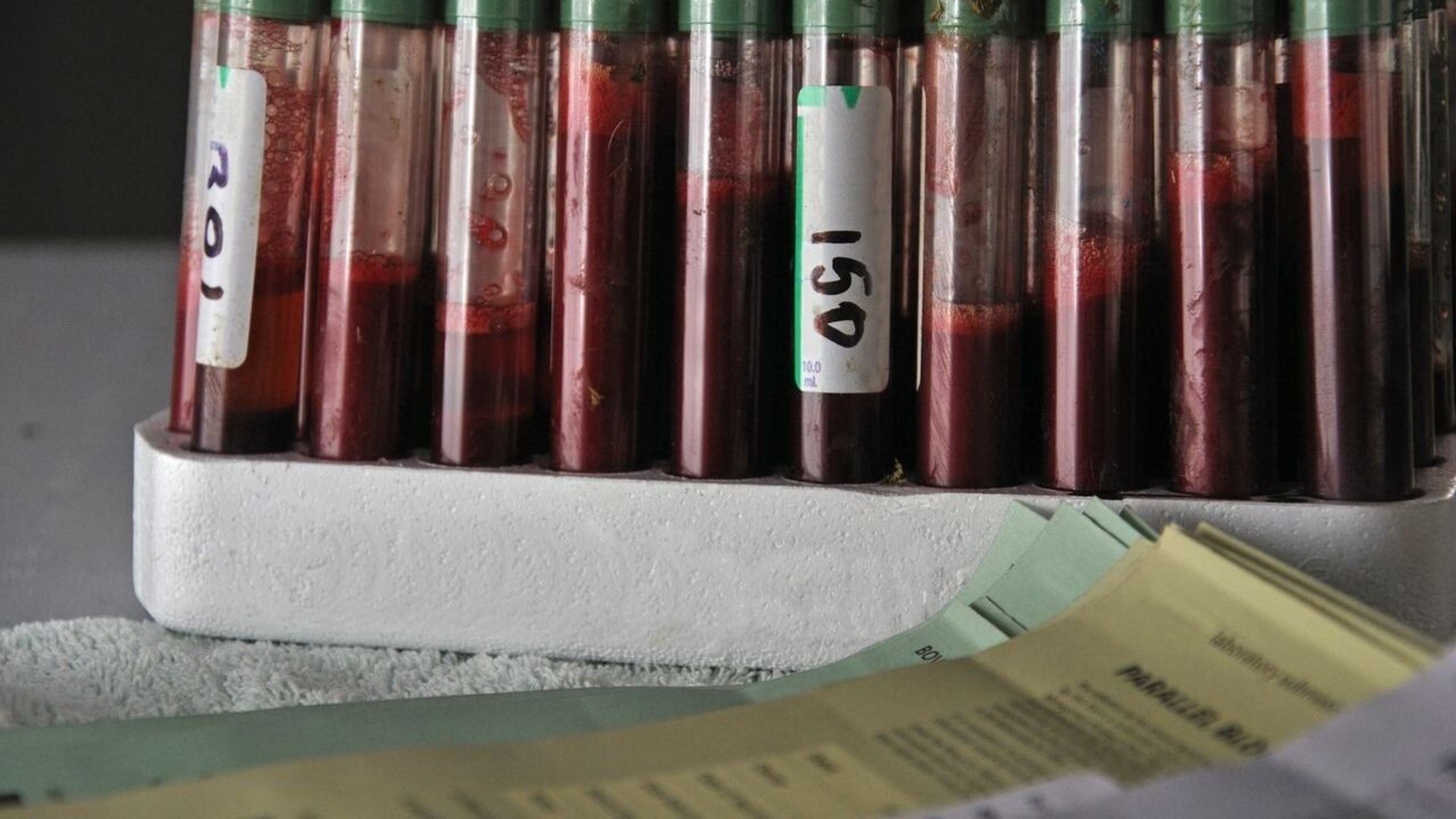 One in five cattle in west Wicklow slaughtered after TB tests as answers sought from Department of Agriculture 