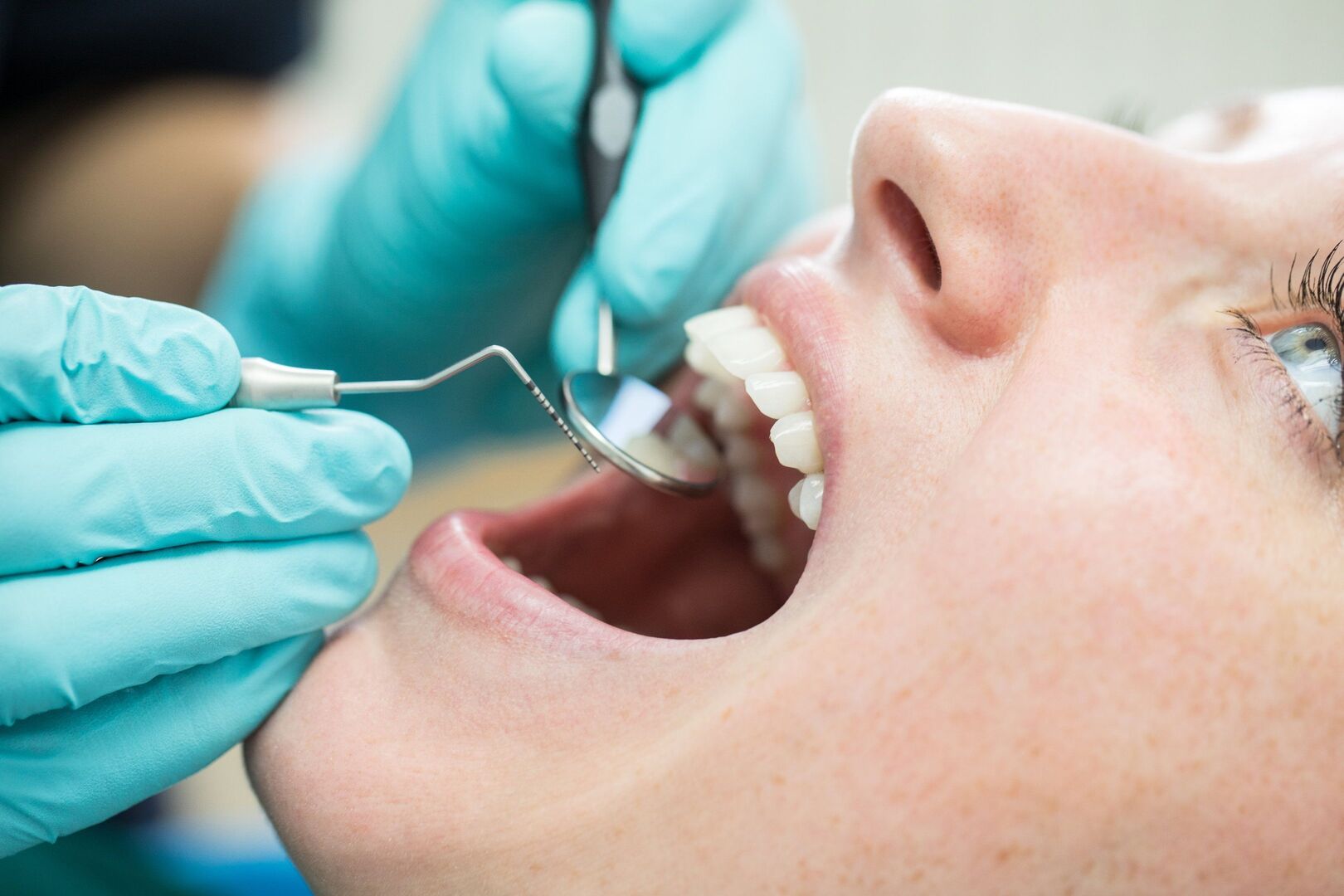 New Report Highlights Serious Dental Health Inequalities in Ireland